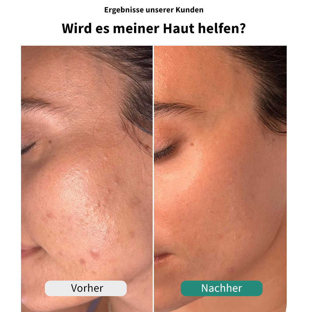 ReinDusche™
